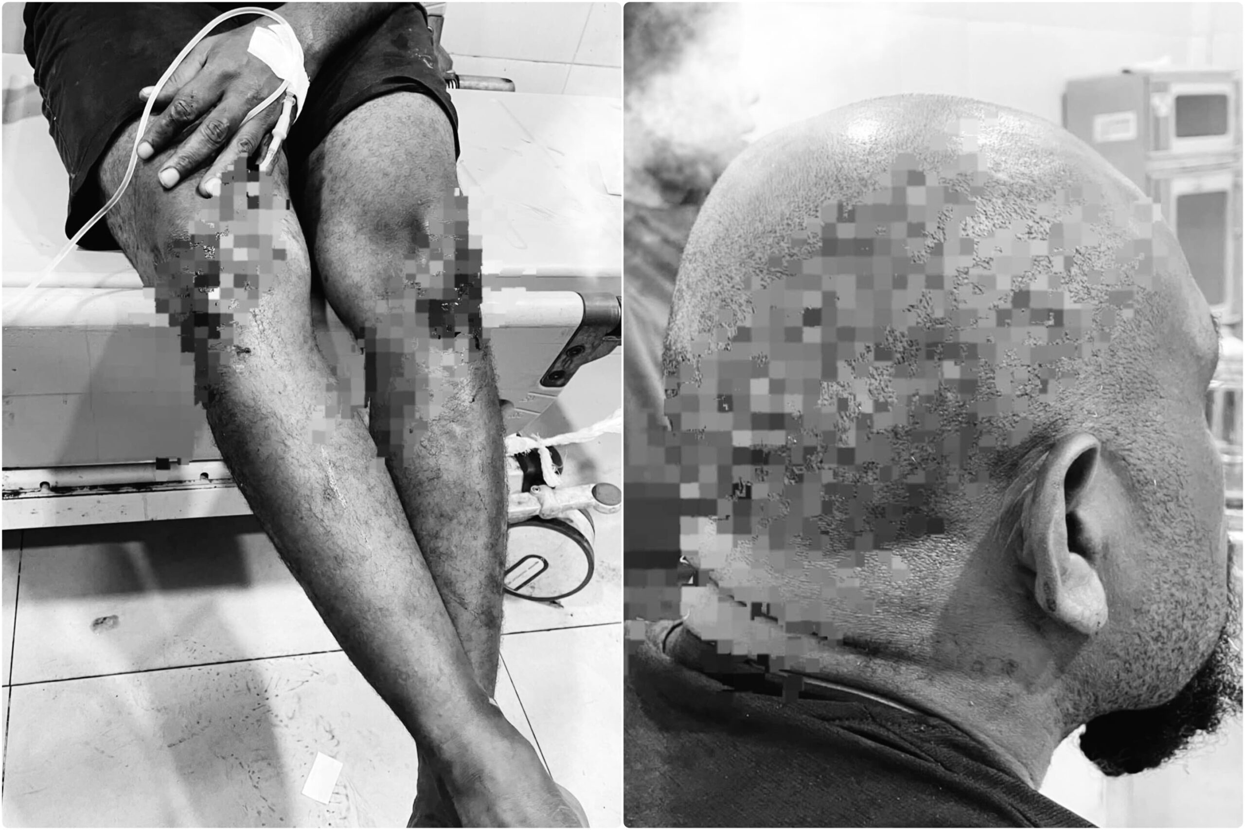 Akibat Miras, Seorang Pemuda Dikeroyok Brutal Kelompok Pemabuk Saat Melintas di Jalan Pendidikan!
